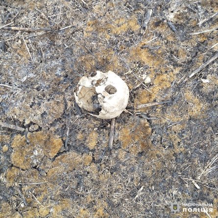 Останки тела человека, кости, Харьковщина