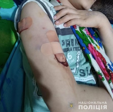 Собака, Каховка, мальчик