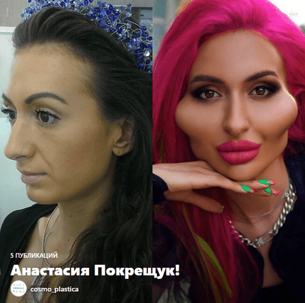 Анастасія Покрещук, Покрещук, блогерка, великі щоки