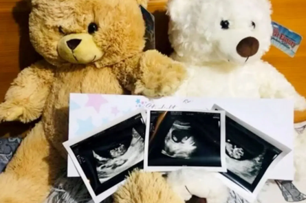 Народження двійнят, перейми, пологи, діти, ускладнення при вагітності, Велика Британія, фото