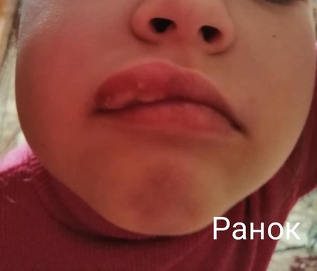 пострадавшая пациентка