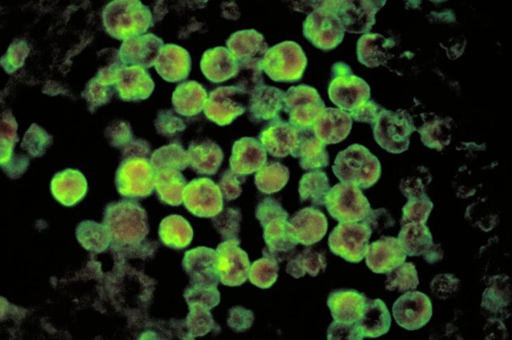 амеба, Naegleria fowleri