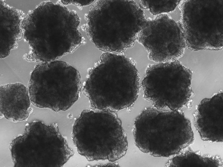 органоиды, мозг, неандертальцы