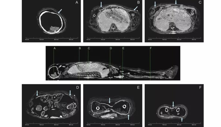 грязевая мумия, Древний Египет