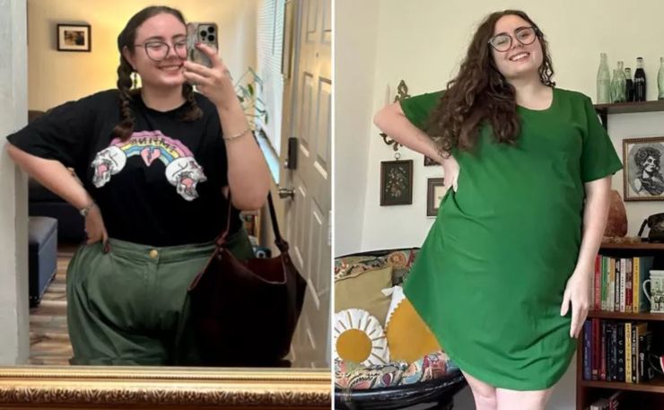 Женщина узнала, что у нее в животе опухоль, хотя до этого думала, что страдает из-за лишнего веса, фото, США