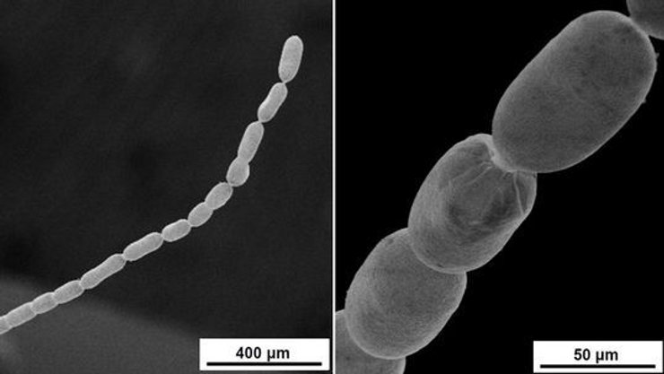 Thiomargarita magnifica, микроскоп, фото