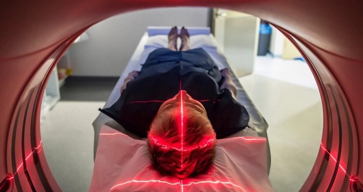 Лікар, лікар, жінка страждала від сильного болю, страждала від болю 20 років, рідкісна хвороба, самостійне обстеження, мрт,