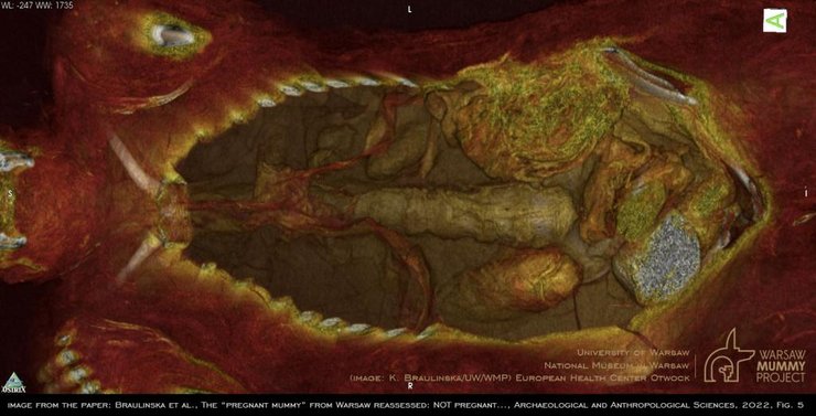 органы, сканирование, мумия, фото