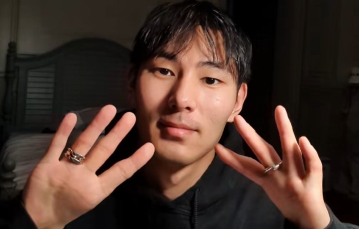 Цяо Алберс показує свої руки без великих пальців крупним планом