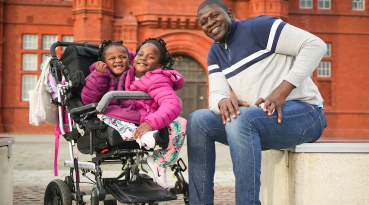 Сиамские близняшки, аномалии, болезни, диагнозы, фото, дети, Великобритания