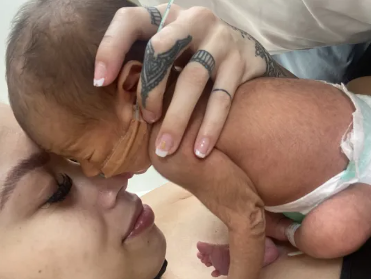 Волосся по всьому тілу в немовлят, зовнішність, дефекти, курйози, пологи, народження дітей, фото, Австралія