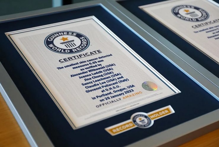 рекорд, Книга рекордов Гиннесса, самый маленький в мире рак кожи