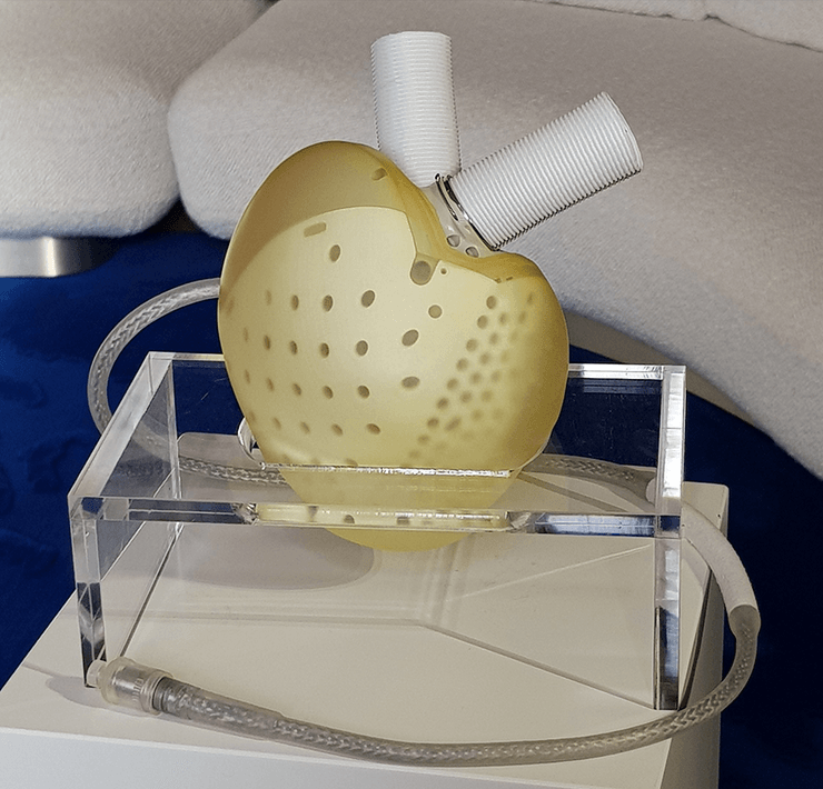 сердце, Carmat, трансплантация, орган, искусственное, франция