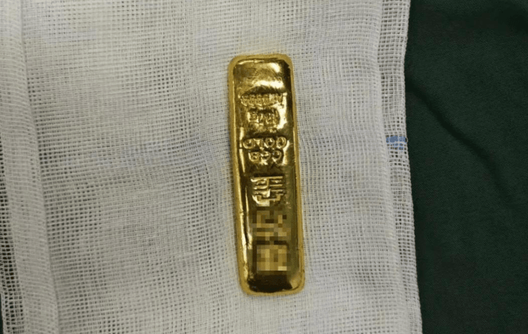 Золотой слиток нашли в желудке 11-летнего мальчика, как это могло произойти, странные истории, инциденты, операции