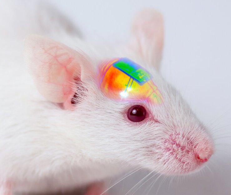 мозкової імплант, нейрочип, мікрочіп, нейрони, вчені, дослідження, корея