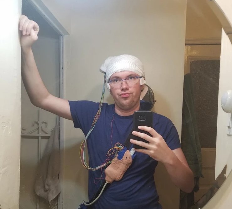 Джоді Сміт, операція, головний мозок,