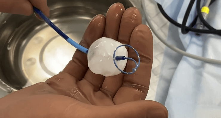 сердце пациента, хирургия, операция на сердце, трансплантологи