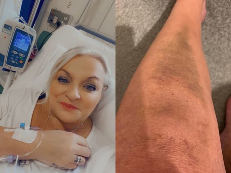 Женщина, травма, нога, больница, болезнь,