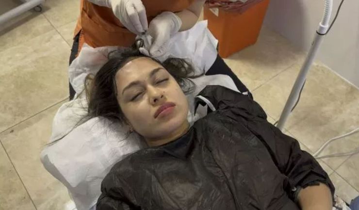 Облысение у женщин, потеря волос, конкурс красоты, внешность, идеал красоты, идеал красоты, трансформация внешности