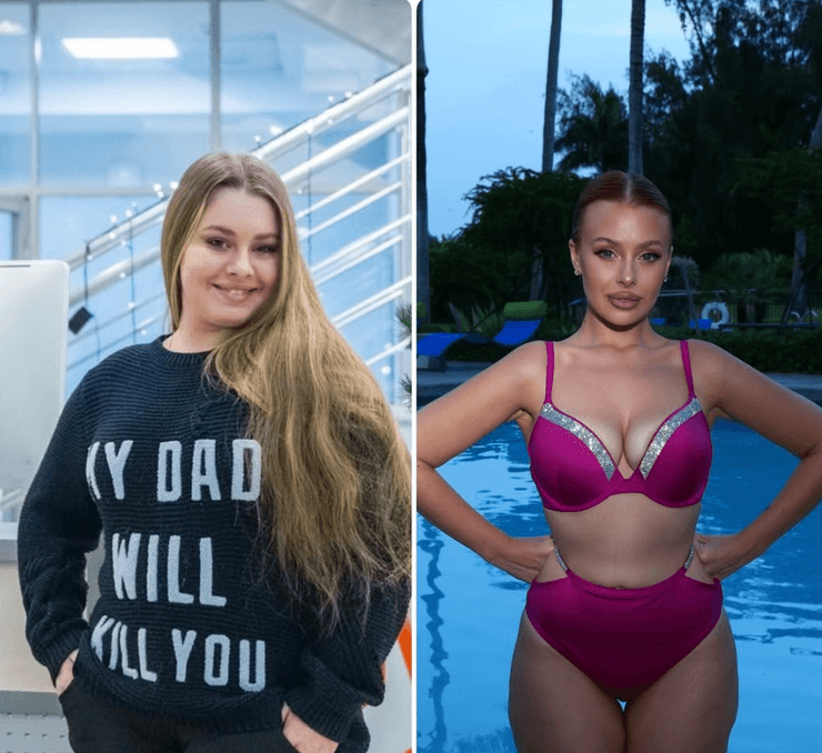 Валерія Симулик до та після