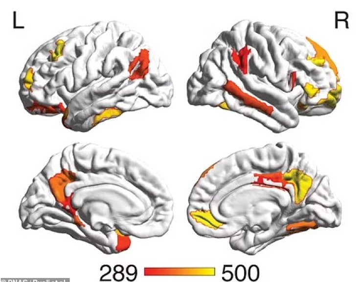 мозг мужчины женщины