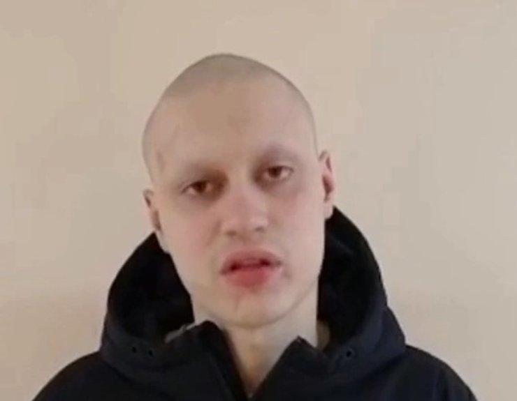 некоглай побои полиция