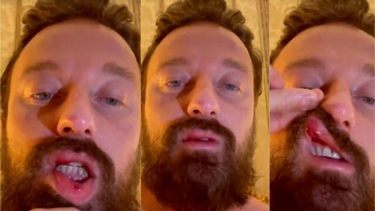 конор макгрегор, франческо факинетти, избил, диджей, итальнский диджей, конор макгрегор драка