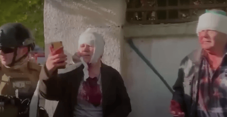 Пострадавшие во время обстрелов