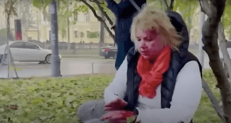 Пострадавшая во время обстрелов