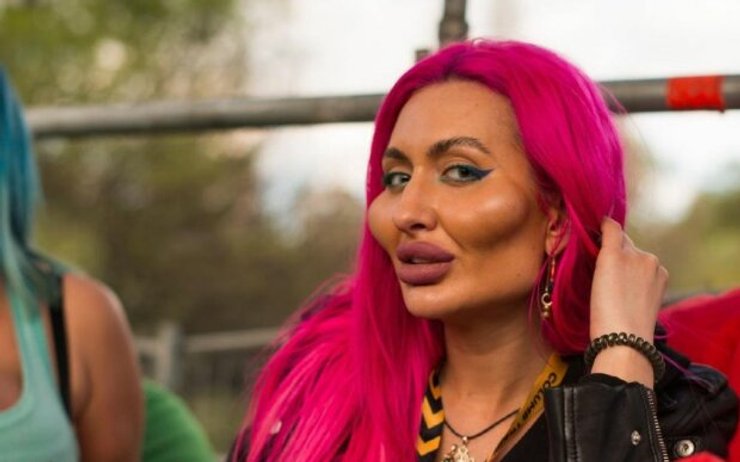 Анастасія Покрещук, українка з найбільшими у світі вилицями, пластичні операції, зовнішність, епатаж, фото