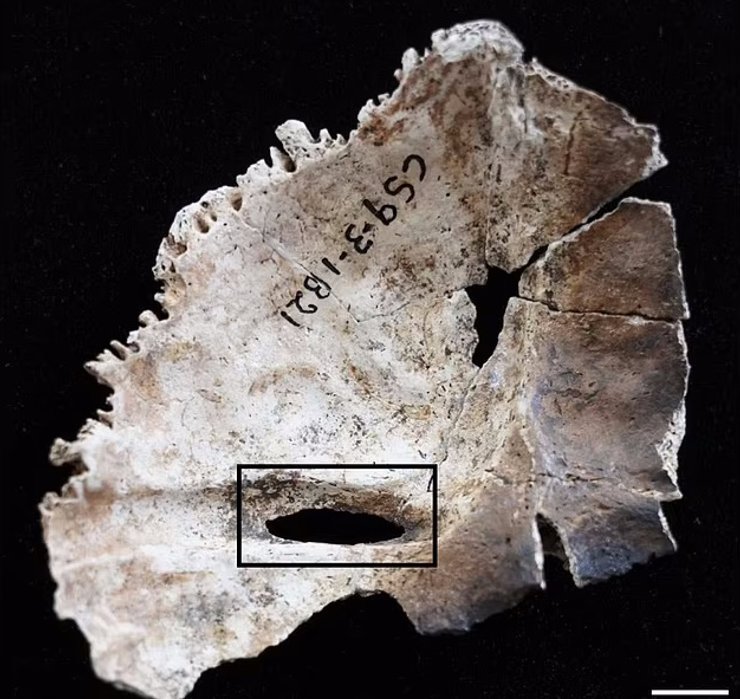 часть черепа