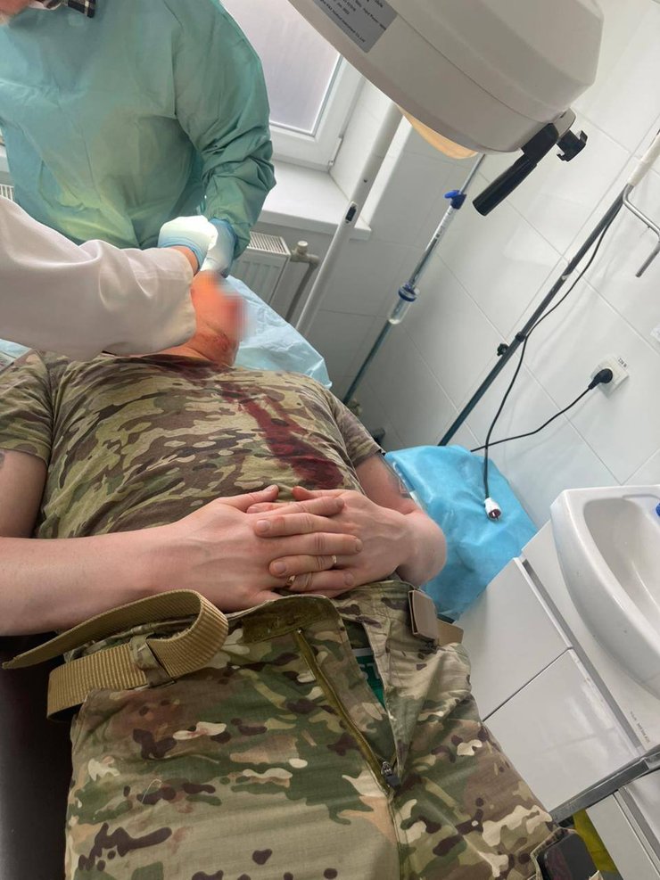 На Закарпатье местные напали на пограничников