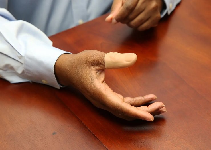 большой палец