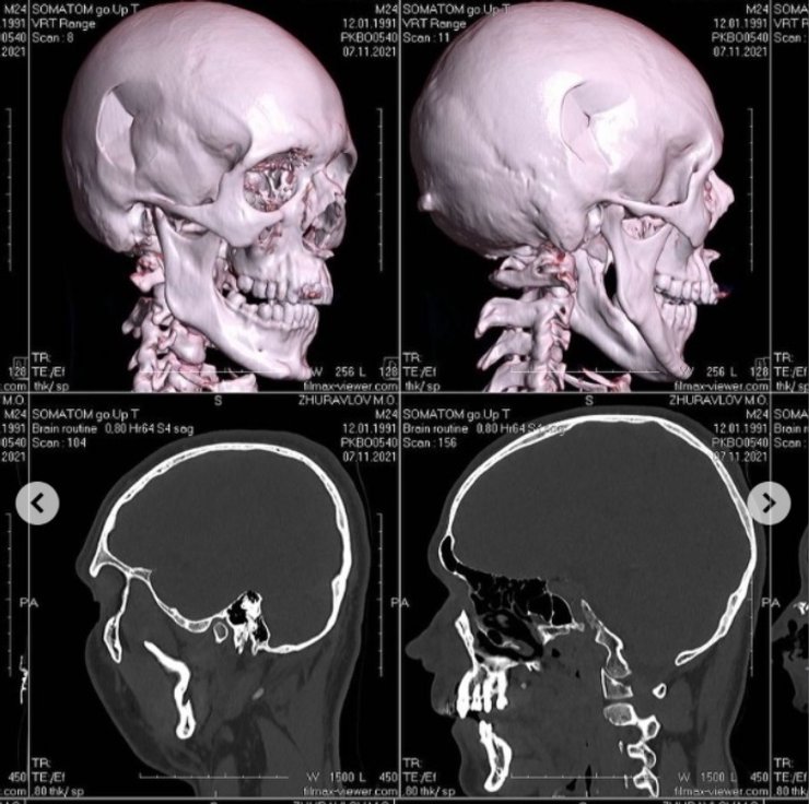 избиение композитора, Николай Журавлев