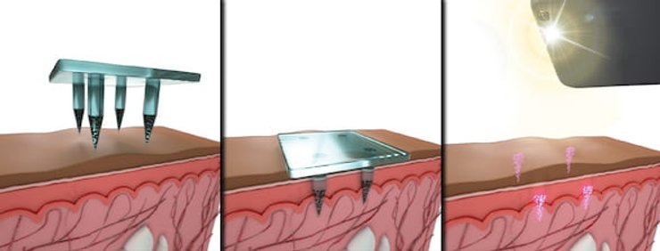 Квантовые точки, вакцина, Билл Гейтс, коронавирус