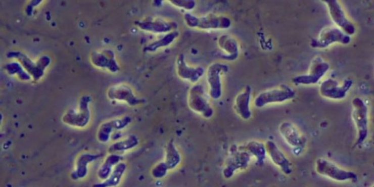 амеба, Naegleria fowleri