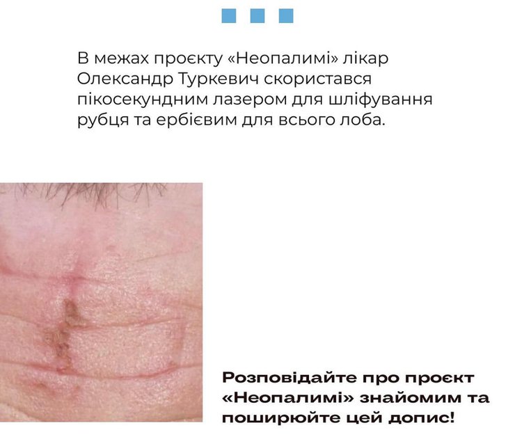 свастика це, нацистська свастика, що таке свастика, свастика це, катування, тортури, російський полон