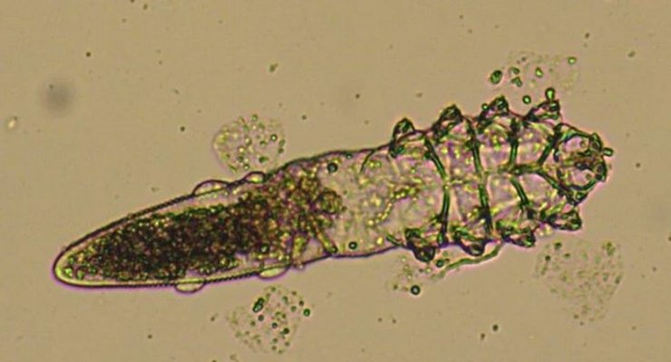 Demodex folliculorum