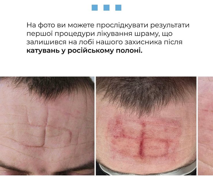 свастика це, фашистська свастика, що таке свастика, свастика це, катування, тортури, російський полон