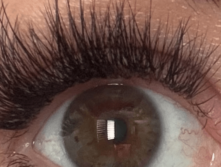 глаз карий, глаза