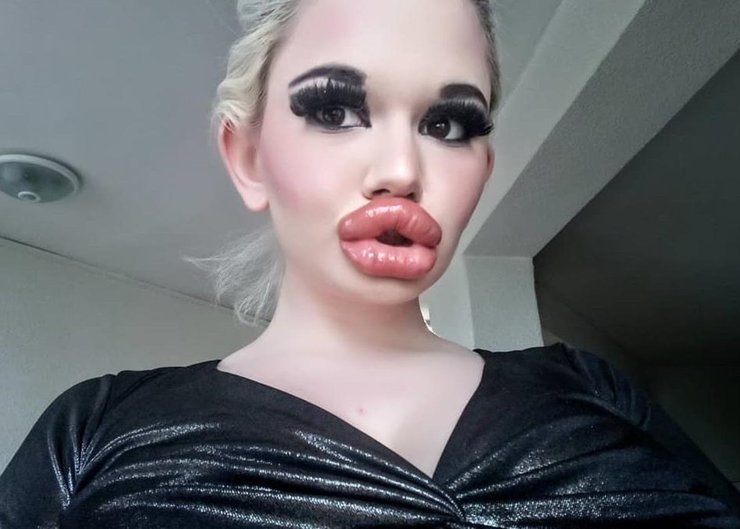 Андреа Иванова из Болгарии, самые большие в мире губы. красота, внешность, косметические процедуры, трансформация, фото, курьезы