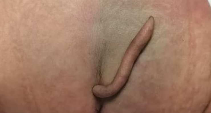 хвіст, людський хвіст