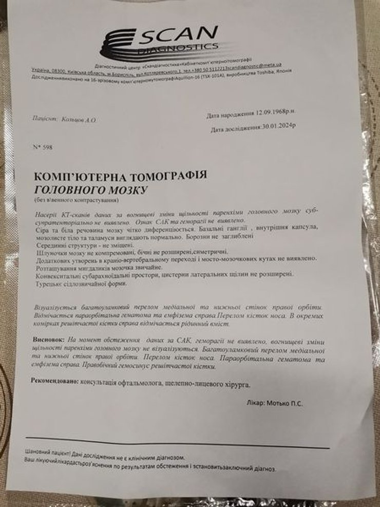 Результат КТ мозку