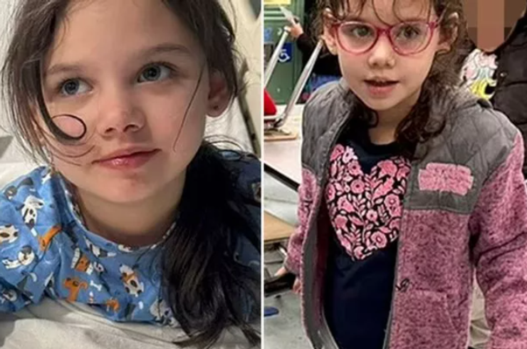 Хлоя Гарсія старіє навпаки через дивний генетичний розлад, аномалія, метахроматична лейкодистрофія, діагнози, фото