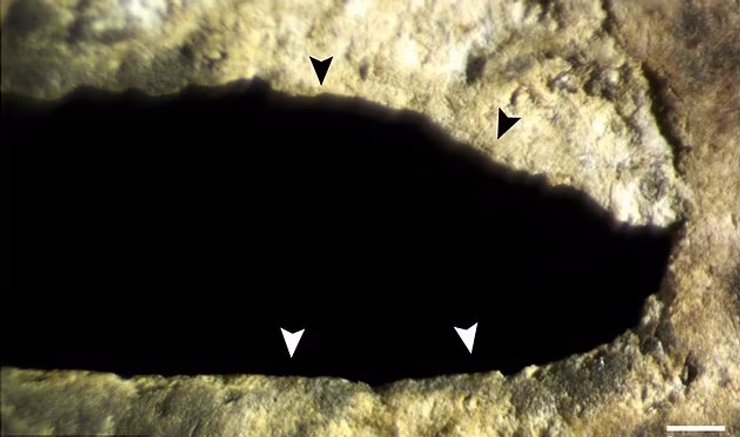 рана на черепе