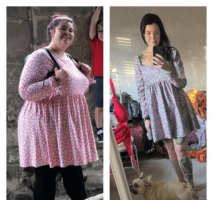 Жінка скинула 63 кг завдяки TikTok, схуднення, операція, зайва вага, скинула зайву вагу, об'їдалася шоколадом, потрапила в пастку