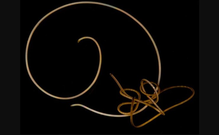 волосяний черв'як