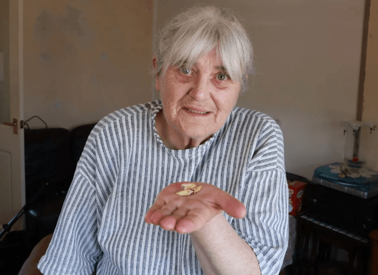 В Британии пенсионер осталась без зубов из-за отсутствия врачей