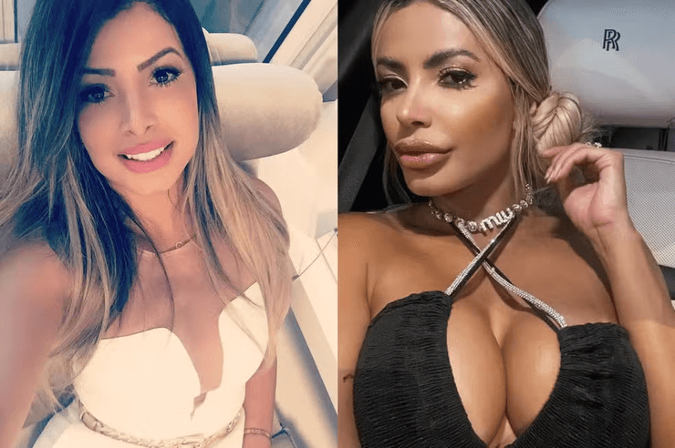 Модель, Яна Прасерес, пластическая операция, перестали узнавать, ринопластика, подтяжка тела, красивая модель, косметическая операция, смена внешности