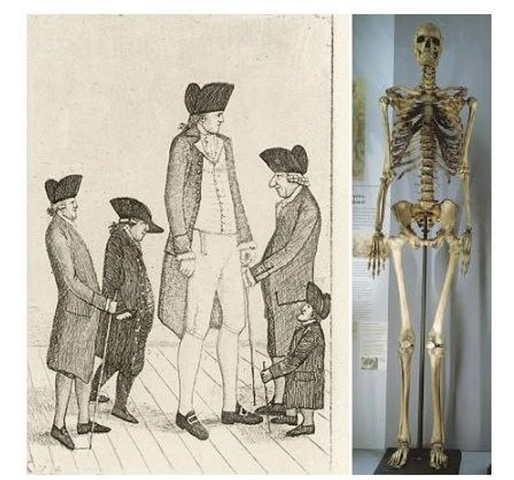 Чарльз Бирн , рисунок, музей, скелет, экспонат, Британия, ирландский великан